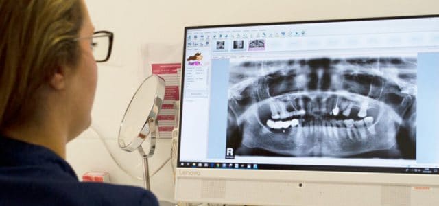 Radiografías de dentaduras postizas