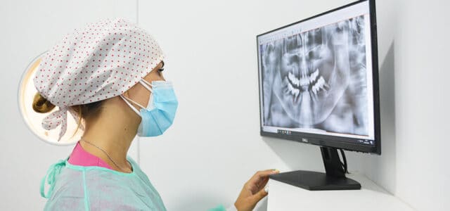 Cirugía de implantes orales